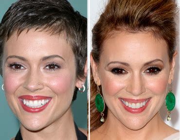 alyssa milano breast implants|Alyssa Milano Breast Augmentation Plastic Surgery .